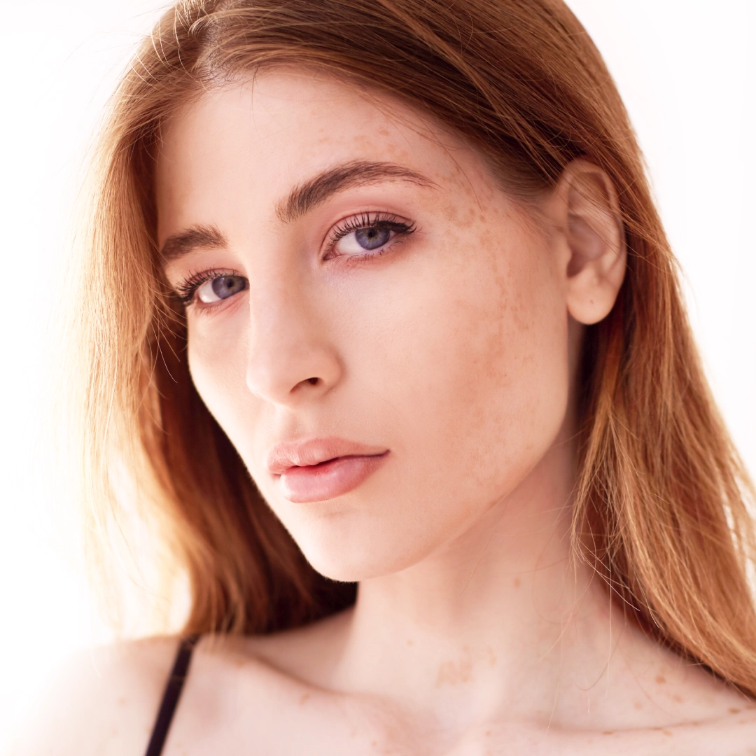 21.05 Коррекция пигментации: выбор тактики и построение комплексного протокола