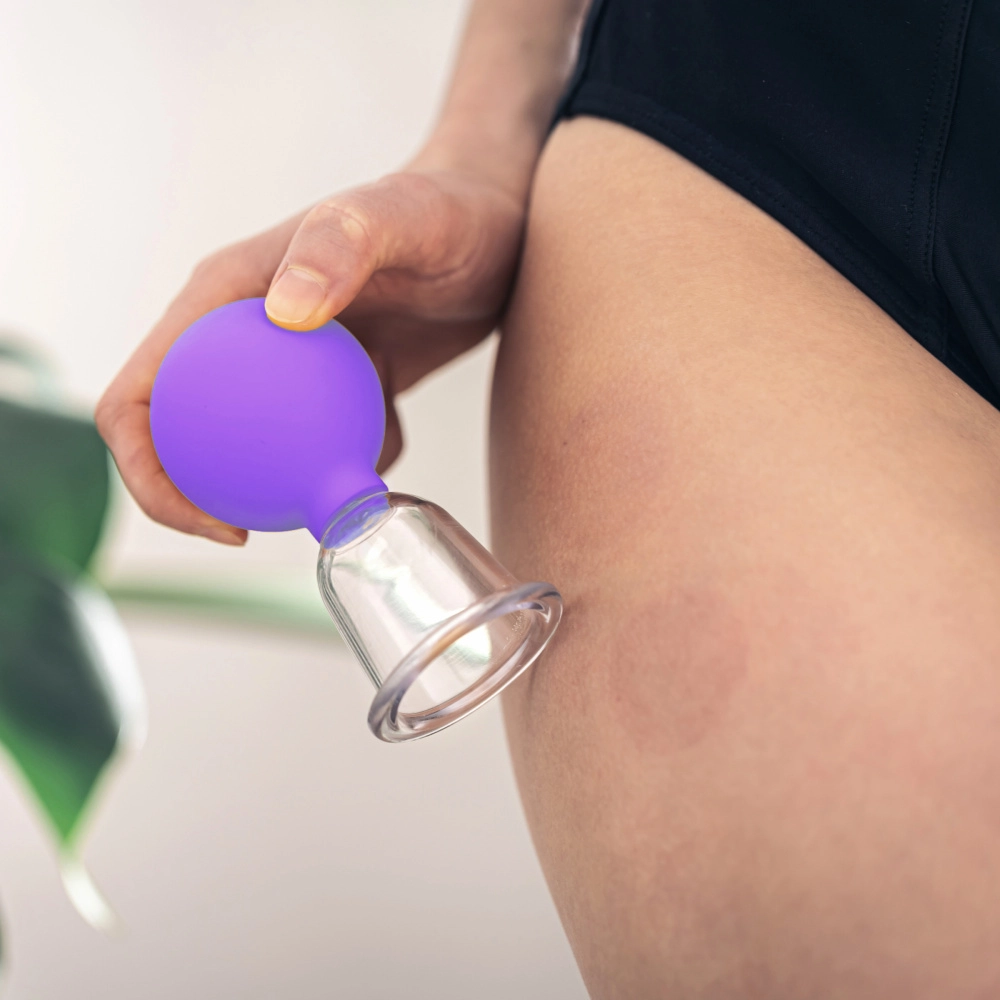 Антицеллюлитный баночный массаж тела