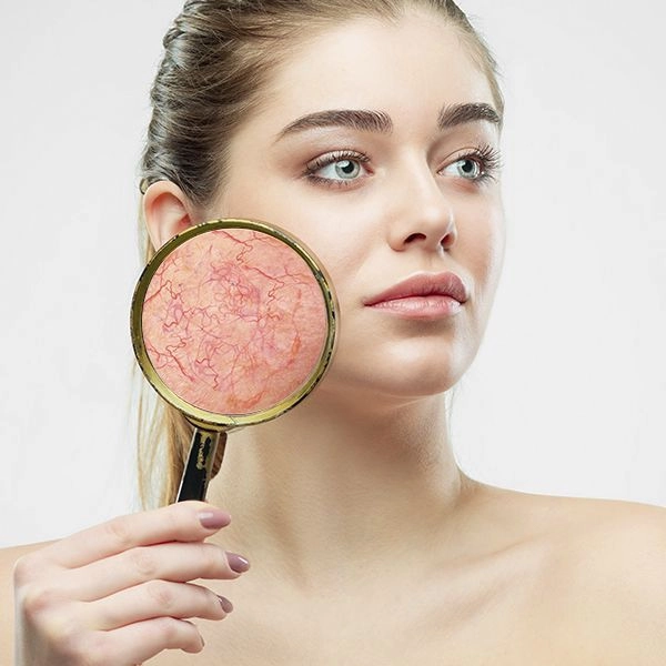 Система профессионального ухода за кожей, склонной к куперозуㅤ